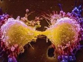 美德两团队同时宣布癌症疫苗试验大获成功，癌细胞已扩散也痊愈！