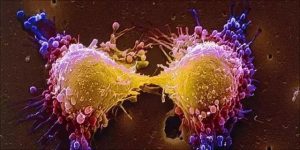 美德两团队同时宣布癌症疫苗试验大获成功，癌细胞已扩散也痊愈！